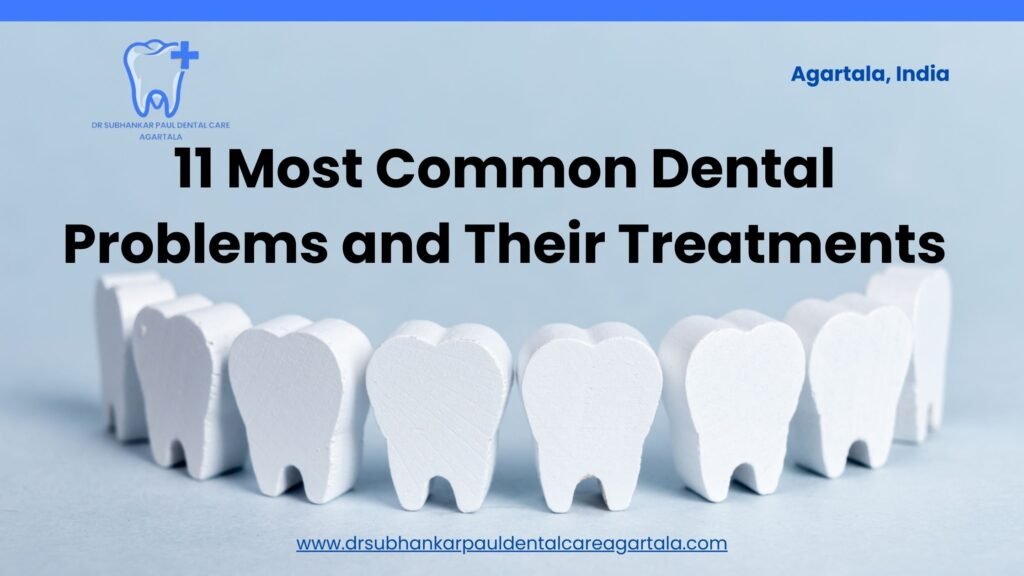 11 Most Common Dental Problems And Their Treatments